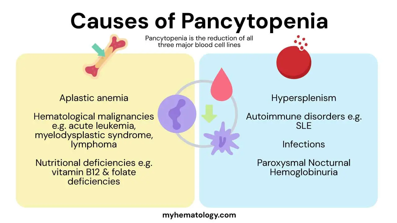 Pancytopenia, a condition characterized by a deficiency of all three major blood cell types, has two main causes. The most common is decreased production in the bone marrow, which can result from damage to hematopoietic stem cells (e.g., in aplastic anemia), infiltration of the marrow by malignant cells (e.g., in leukemias and lymphomas), or ineffective blood cell production due to nutritional deficiencies (e.g., Vitamin B12 deficiency) or genetic disorders (e.g., myelodysplastic syndromes). The second cause is increased destruction or sequestration of blood cells in the periphery, which can be due to an overactive spleen (hypersplenism) or an immune-mediated attack on blood cells (e.g., in autoimmune diseases like SLE or conditions like Paroxysmal Nocturnal Hemoglobinuria).