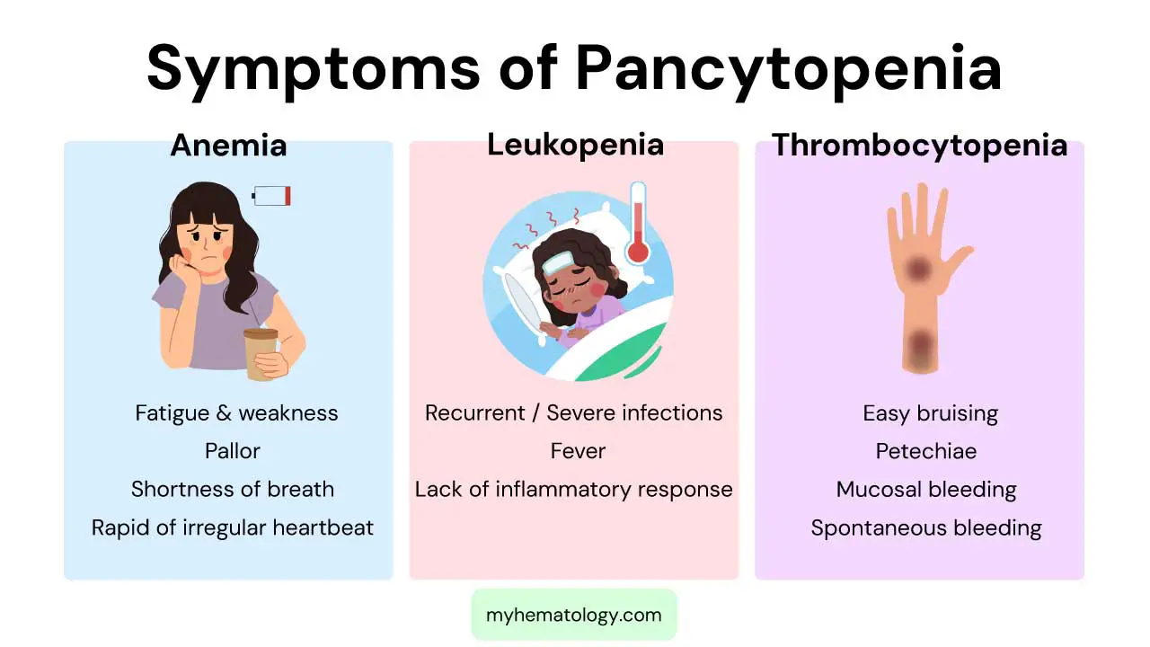 Symptoms of pancytopenia includes symptoms of anemia, leukopenia and thrombocytopenia