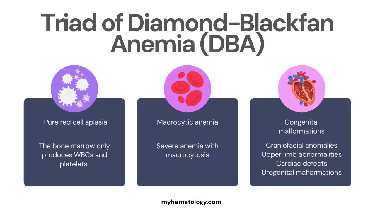 Triad symptoms of Diamond-Blackfan anemia (DBA) typically refers to pure red cell aplasia, macrocytic anemia and congenital malformations which are key clues for diagnosis. 
